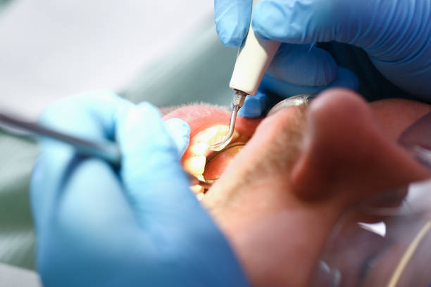 Best Walk-In Emergency Dental Services in Sulphur, OK