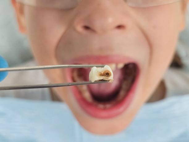 Best Emergency Pediatric Dental Care in Sulphur, OK